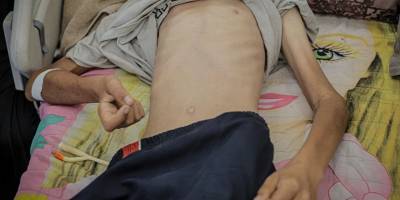 24 saatte 9 Filistinli daha açlıktan can verdi