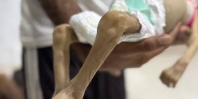 Gazze'yi açlığa mahkum eden İsrail, İngiltere'de tencere ve tavalarla protesto edildi