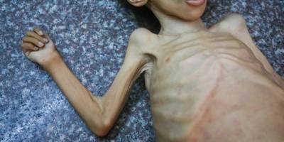 BM: Gazze'de her 3 kişiden biri günlerdir yemek yemedi