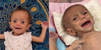 IPC: Gazze'de en şiddetli kıtlık durumu yaşanıyor