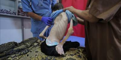 Gazze’de son 24 saatte 2'si çocuk 3 kişi daha açlıktan hayatını kaybetti