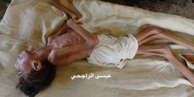 Yemen'de açlıktan ölümler başladı