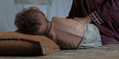 Gazze'de 100 çocuk açlıktan can verdi