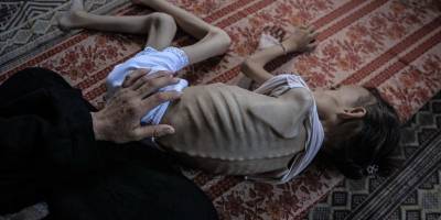 Gazze'de son 24 saatte 2'si çocuk 7 Filistinli daha açlıktan can verdi