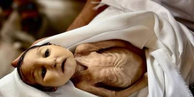 Gazze'de kıtlık resmeni ilan edildi