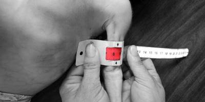 Gazze'de açlıktan can verenlerin sayısı 117'si çocuk 300'e yükseldi