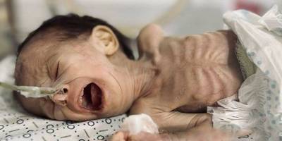 Euro-Med: İsrail açlığı planlı bir şekilde oluşturdu, cezalandırılması gerekir