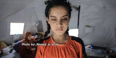 İşgal rejimi Gazze'de binlerce kişiyi kör etti