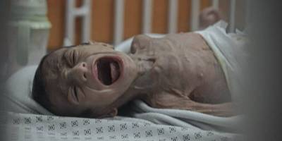 Gazze'de 24 saatte 3'ü çocuk 10 kişi açlıktan can verdi