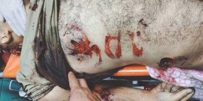 İşgal rejimi Filistinli şehidin naaşına zarar verdi