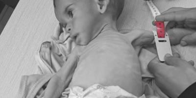 Gazze'de açlıktan can verenlerin sayısı 145'i çocuk 420'ye yükseldi