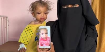 Gazze'de hastanelerdeki çocuklar adeta ölümü bekliyor