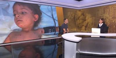 “Çocukların acısını sayamaz oldum”