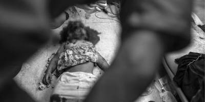 Gazze’de doktorlar ameliyatları anestezisiz yapıyor