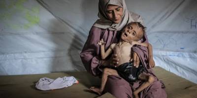 UNRWA: Gazze'de her üç çocuktan biri 24 saattir yemek yemiyor