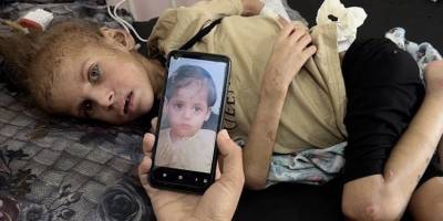 Gazze’de açlıktan 12 kiloya düşen May artık yürüyemiyor