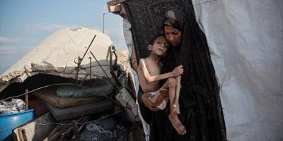 Gazze’de açlıktan ölenlerin sayısı 457 oldu