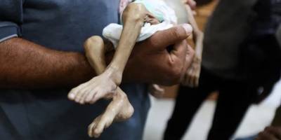 UNICEF: Gazze’de 20 bin çocuğun öldürülmesine dünyanın sessiz kalmasını hayretle karşılıyoruz