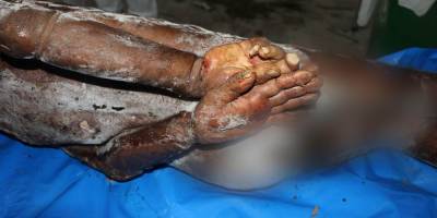 Katil İsrail, 195 cesedi Gazze'ye iade etti; çoğu elleri bağlı ve işkence izleri taşıyan cesetlerdi (Foto – Belge)