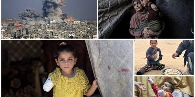 Siyonist saldırılarda binlerce çocuk ampute edildi