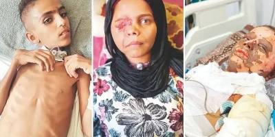 Gazzeli çocuklar tedavi bekliyor