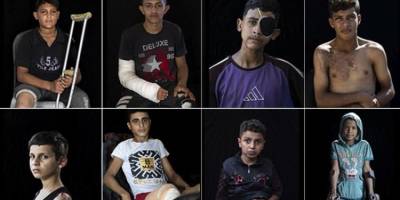 Gazze'de 5 bini aşkın çocuk ampute edildi