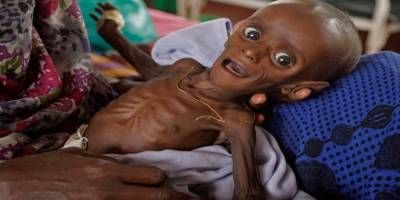 Dünya Bankası: Yemen kıtlığın eşiğinde