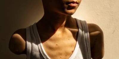 Gazze'de 42 bin kişi hayat boyu bakıma muhtaç