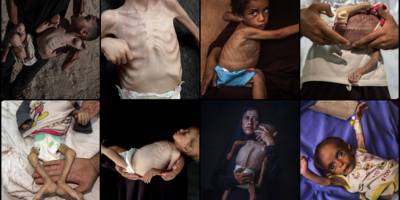 Batı’ya göre Gazze’de hayat hiyerarşisi: Eşekler çıktı, çocuklar kaldı