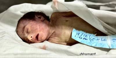 Gazze'de bir aylık bebek donarak can verdi