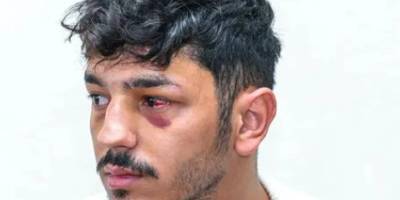 13 siyonist polis, Filistinli güvenlik görevlisini darp etti