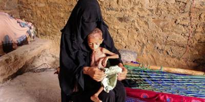 BM uyarısı: Yemen’de açlık tehlikesi büyüyor