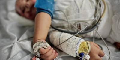 Gazze'de yanık hastaları için gerekli tıbbi malzemeler tükenmek üzere