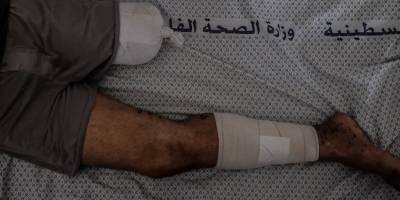 Soykırım şebekesinin dinmeyen cinayet iştahı