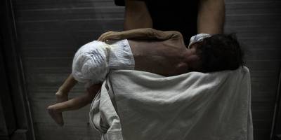 Gazze'de bebek ölümleri ve doğum kusurları artıyor