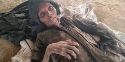 Unutulan Yemen'de insanlar açlıktan ölüyor