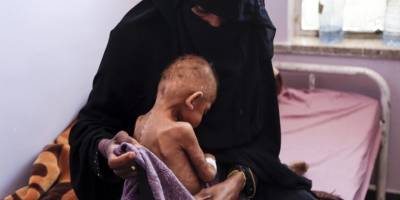 BM: Yemen'de 18 milyondan fazla insan şiddetli açlık çekiyor