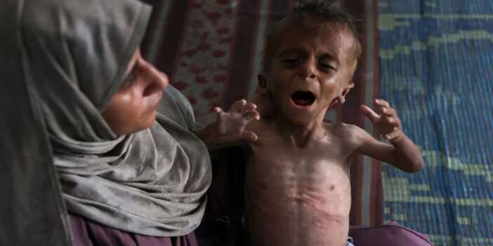 İsrail destekçileri neden UNICEF araştırmasını çarpıtıyor?