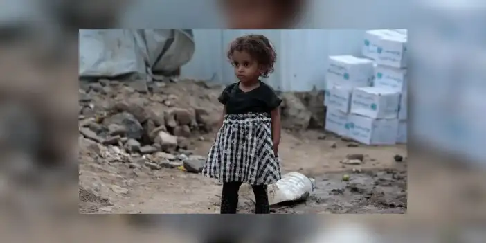 UNICEF: Yemen'de 5 yaş altı 2,2 milyon çocuk akut yetersiz beslenme sorunu yaşıyor