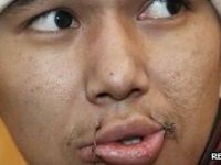 Kırgızistanda Mahkumlar Dudaklarını Dikiyor