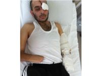 Ellerim ve Gözlerim Özgür Suriyeye Feda Olsun!