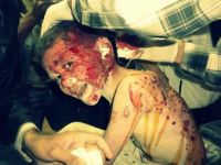 Suriye’de Yine Kimyasal Silah İzleri