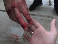 Suriye’de 9’u Çocuk 128 Kişi Daha Katledildi