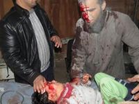 Katil Uçaklar Suriyelileri Diri Diri Yaktı!