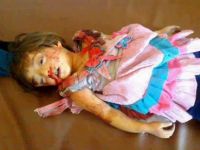 Suriye’de Dün 119 Kardeşimiz Katledildi