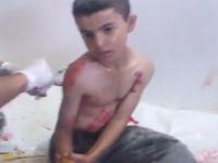 Suriye’de 118 Kardeşimiz Katledildi (VİDEO)