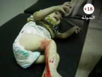 Suriye’de 8 Aylık Bilanço: 35 Bin 552 Ölü (VİDEO)