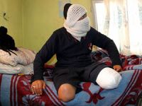 Savaşın Yarım Bıraktığı Bedenler