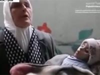 Yermuk: Açlıktan Ölüm Kampı (VİDEO)