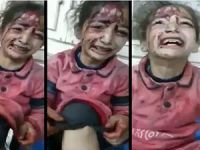 Suriye'den İnsanlığı Utandıran Bir Görüntü Daha!